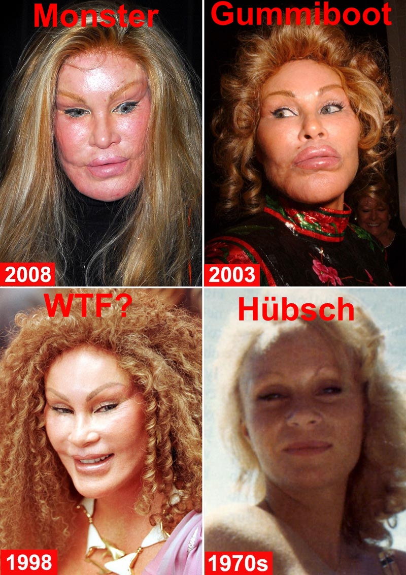 2012/04/jocelyn-wildensteinscheisseimergesicht